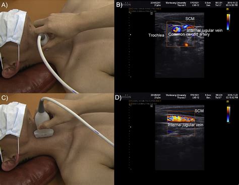 Development Of An Ultrasound Imaging Procedure And Acquisition Of