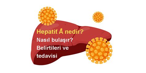 Hepatit A nedir Nasıl bulaşır Belirtileri ve tedavisi