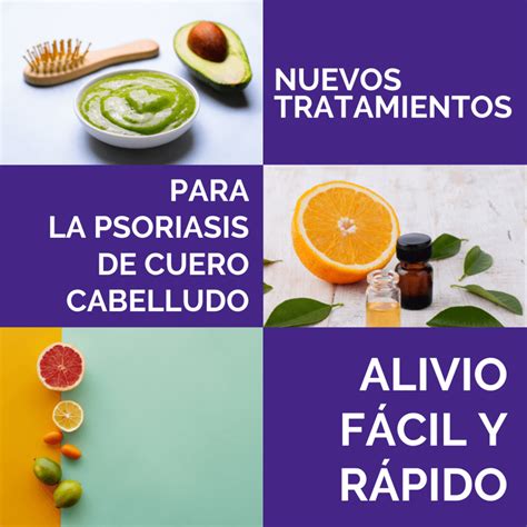 Mejores Tratamientos Para La Psoriasis Del Cuero Cabelludo Theanswerguide