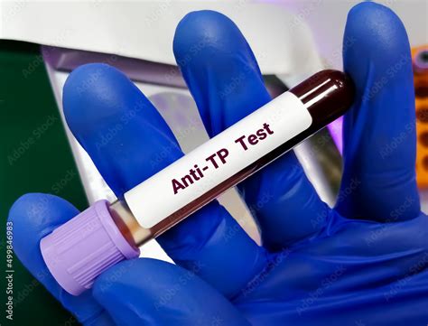 Blood Sample For Anti Treponema Pallidum Or Anti Tp Test Diagnosis