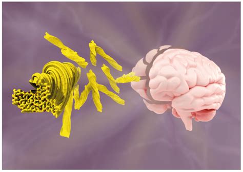 Scientists Discover Protein Linked To Early Onset Dementia Clinical Lab Products