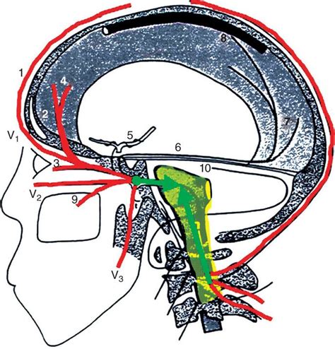 Occipital Nerve Block Injection