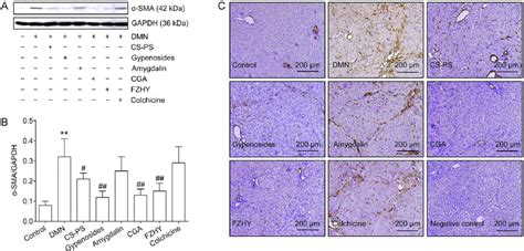 Effects Of Cga On Smooth Muscle Actin Sma Expression In Liver