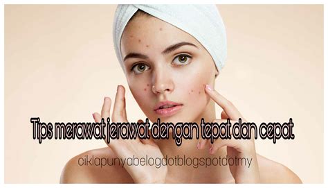 Mahu Merawat Jerawat Dengan Tepat Dan Cepat Baca Tips Ni Ciklapunyabelog Dot Blogspot Dot My