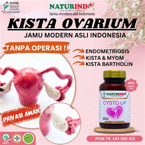 Jual Obat Kista Miom Mioma Myoma Herbal Coklat Kista Endometriosis