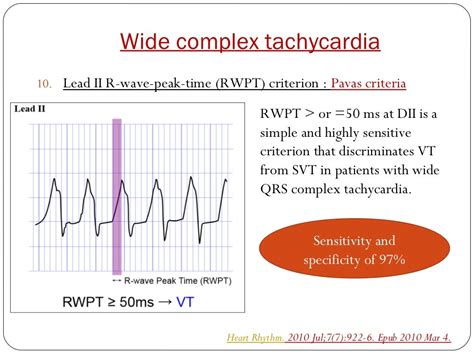 WIDE QRS TACHYCARDIA