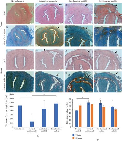 Histological Evaluation Of Reconstruction Of Partial Uterine Cervical