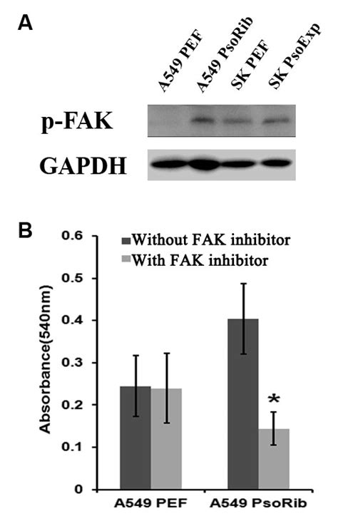 Involvement Of Focal Adhesion Kinase Fak In Adhesion Of Nsclc Cells