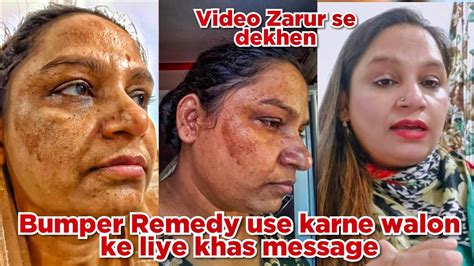 Bumper Remedy Use Karne Walon Ke Liye Khas Message Youtube