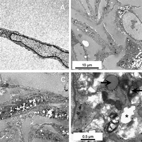 Transmission Electron Micrograph Of Normal Fibroblasts A In