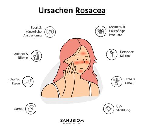 Rosacea Ursachen Symptome Behandlung Sanubiom