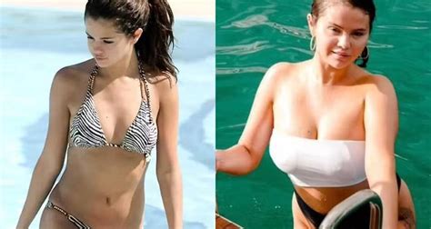 Selena Gomez Compara Antes E Depois De Seu Corpo Orgulho MundoBoaForma