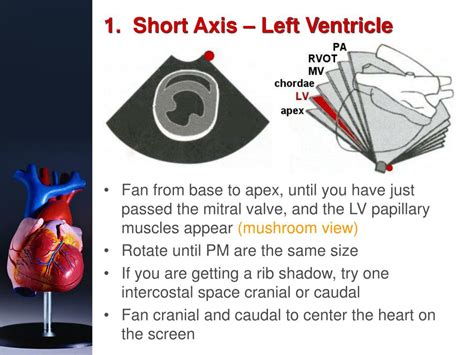 Ppt Basic Echocardiography Powerpoint Presentation Free Download