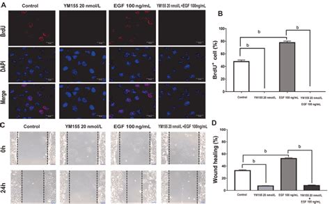 Ym155 Inhibits Arpe 19 Cells Proliferative And Migrative Capacity Download Scientific Diagram