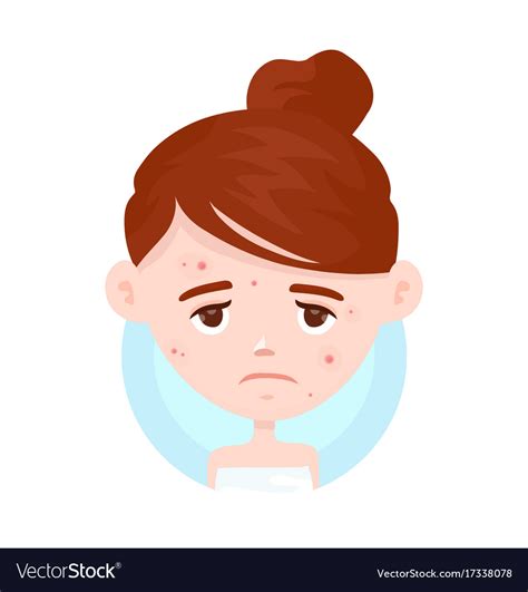 Unhappy Teen Girl Struggling Acne Royalty Free Vector Image