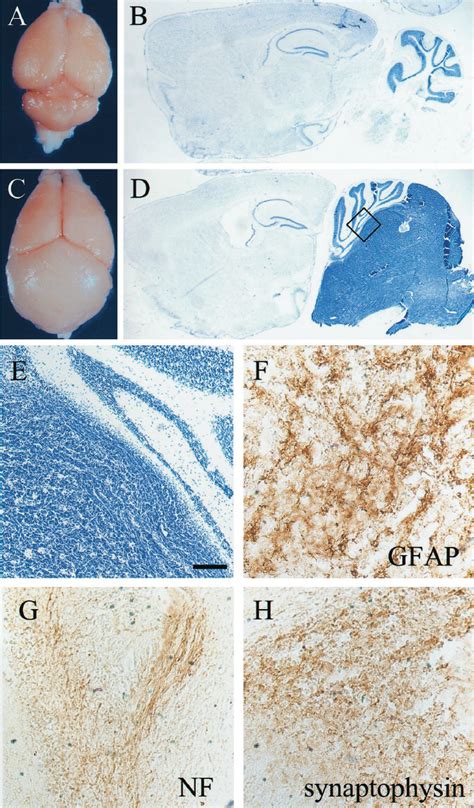 Gross And Histological Appearance Of Medulloblastoma In Ptc Mice