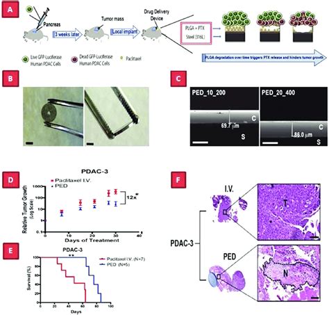 Design Characterization And In Vivo Antitumor Performance Of