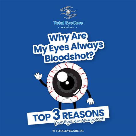 WHY MY EYES ARE RED ALL THE TIME?... - Total EyeCare Center