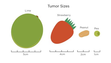 Stages & Grades Of Breast Cancer | My Breast Cancer Compass