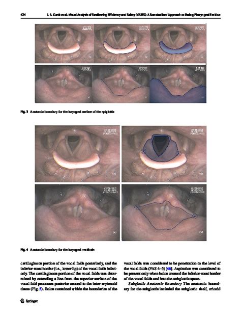 Download Visual Analysis Of Swallowing Efficiency And Safety Vases A