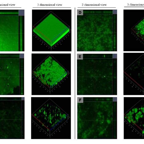 Clsm Reveals The Architecture Of P Aeruginosa Matured Biofilm