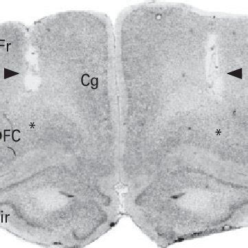 Representative Photomicrograph Of A Cresyl Violet Stained Coronal