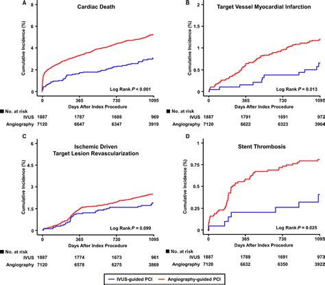 Role Of Intravascular UltrasoundGuided Percutaneous Coronary