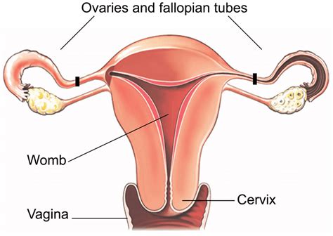 Laparoscopic Sterilisation Healthdirect