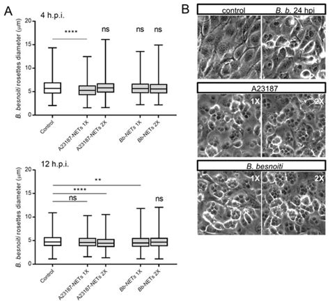 Biology | Special Issue : Neutrophil Extracellular Traps