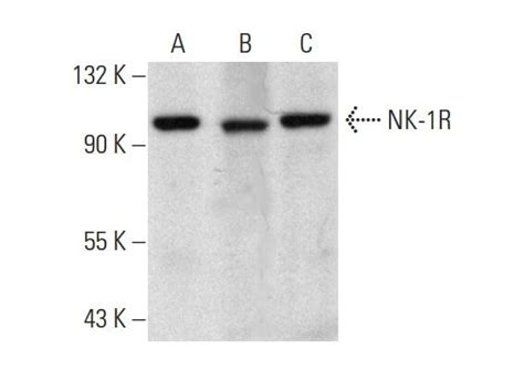 NK 1R抗体 D 11 SCBT Santa Cruz Biotechnology