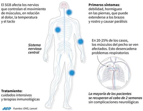 S Ndrome De Guillain Barr S Ntomas Causas Y Tratamientos De La