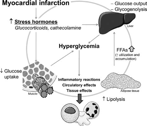 Hyperglycemia In Acute Coronary Syndromes From Mechanisms To