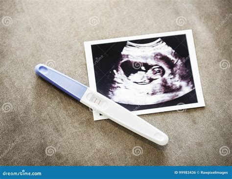 Baby Ultrasound Scan Photo with Pregnancy Test Stock Photo - Image of ...