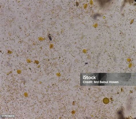 Giardia Lamblia Cysts And Trophozoite Form Muscle Fiber In Stool Examination Under 40x Light