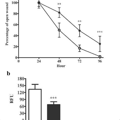 MiR 107 Inhibits Migratory Capacity Of Melanoma Cells A Graphic