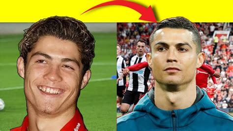 Ronaldo Plastic Surgery Face Change Explained YouTube