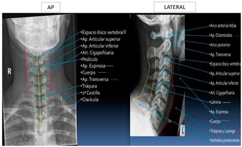 Anatomía De La Columna Cervical Dolopedia