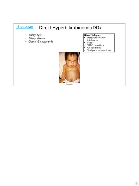 Solution Neonatal Jaundice Direct Studypool