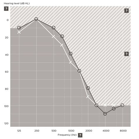 The human hearing range - from birdsong to loud sounds