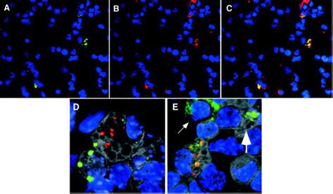 Reovirus T1l Antigen In Association With Activated Caspase 3 And