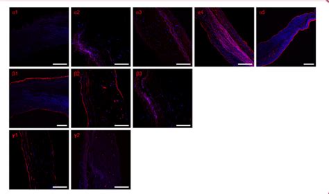 Laminin Chain Expression In Human Aortic Valves The Endothelial