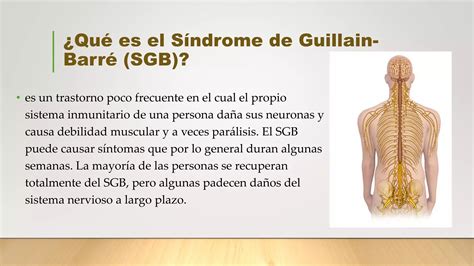 El Síndrome de Guillain Barré pdf