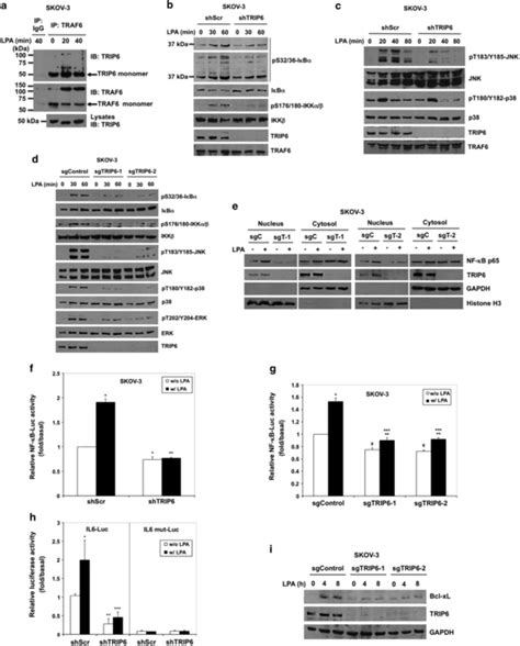 Depletion Of Trip Eliminates Lpa Induced Nf B And Map Kinase