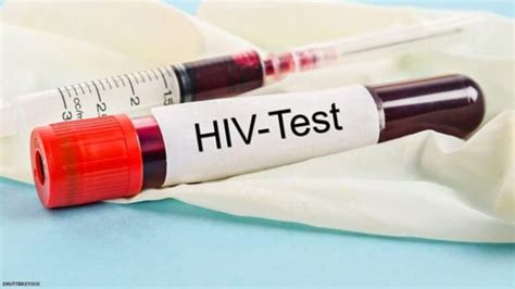 All You Need To Know About Hiv Testing