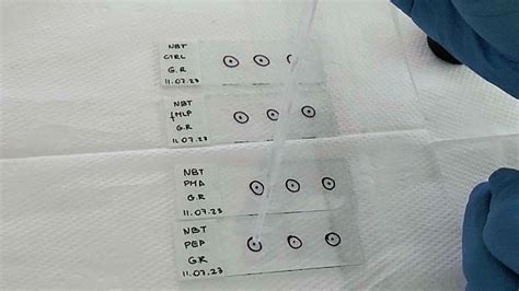 Nitrotetrazolium Blue Chloride Nbt Assay For Evaluating Ros Production