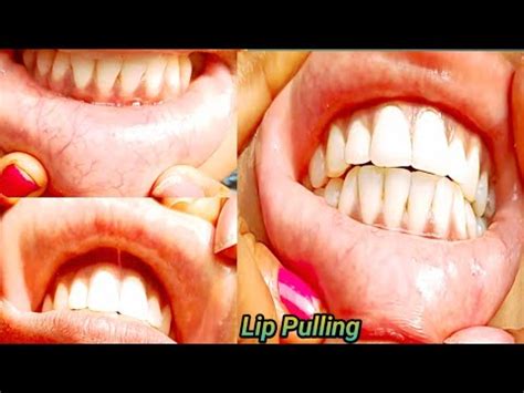 Lip Pulling Challenge Lip Pulling YouTube