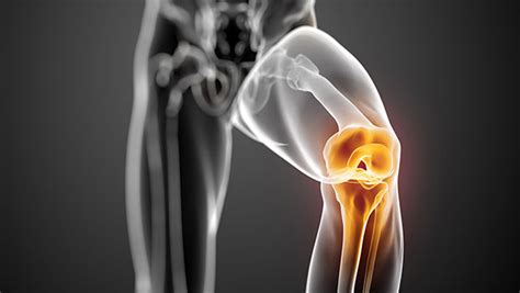 Knee Arthroscopy – Kmh Health blog