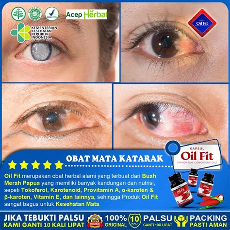 Jual Obat Khusus Mata Katarak Glaukoma Glukoma Mata Berlemak Pterygium