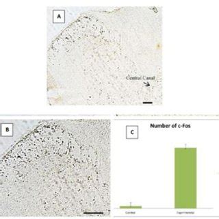 Photomicrographs Showing The Expression Of C Fos Protein In The Dorsal