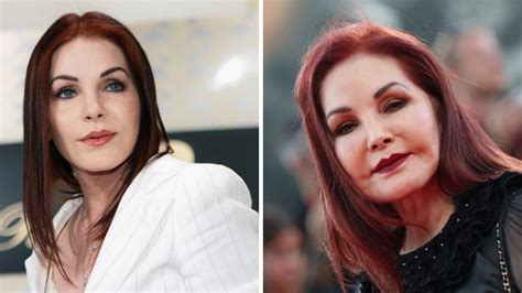 Priscilla Presley Plastic Surgery: A Deep Dive Into Hollywood's ...